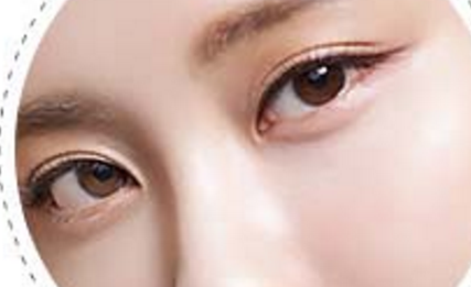 艺星美容上睑下垂手术需要多久可以恢复?