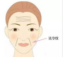 艺星美容医院祛除法令纹效果怎么样呢?
