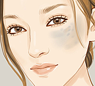 艺星美容医院激光祛痣效果怎么样呢？