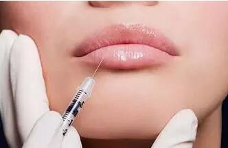 艺星注射填充注射嘴唇的术后护理工作有哪些？