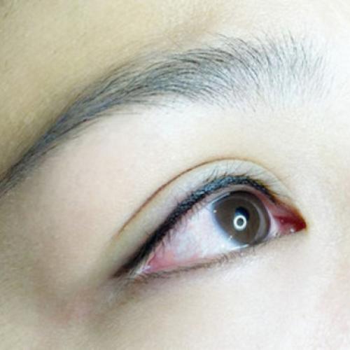 长沙艺星医院纹眼线要多久恢复呢？