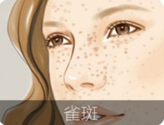 长沙艺星祛斑有哪些优势呢？