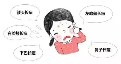 长沙艺星医院治疗痘痘有哪些注意事项呢？