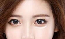 长沙艺星怎么样才能拥有卧蚕呢?