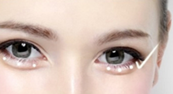 长沙艺星做卧蚕整形手术需要多少费用呢?