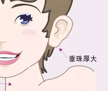长沙整形胶原蛋白丰耳垂的优势有哪些呢？