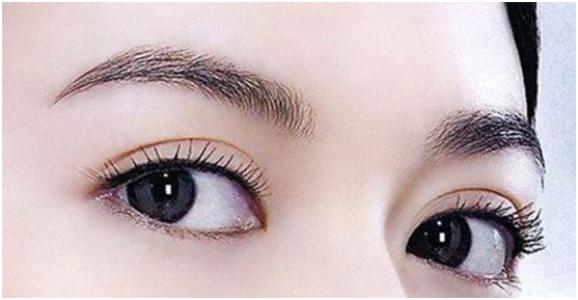 长沙开眼角整形会留疤吗?