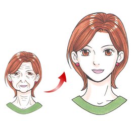 长沙自体脂肪填充