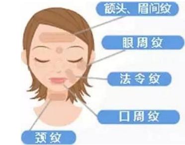 长沙注射填充注射除皱的价格
