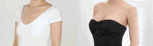 长沙乳晕飘红多少钱