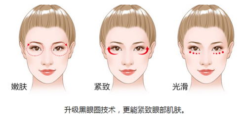 黑眼圈需要多久才能去除