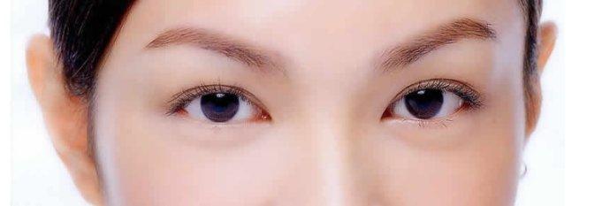 上睑下垂矫正术后应该注意的事项有哪些?
